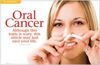 Oral cancer 2