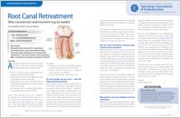 root canal retreatment 2