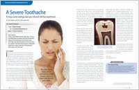 Tooth sensitivity 6