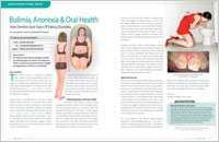 Bulimia Anorexia - Dear Doctor Magazine