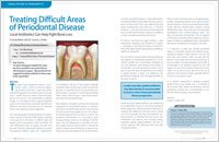 Periodontal Disease - Dear Doctor Magazine